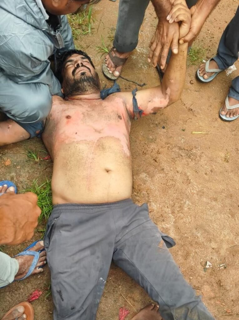విధి నిర్వాహణలో ప్రమాదం విద్యుత్ శాఖ జూనియర్‌ లైన్మెన్‌కు తీవ్ర గాయాలు